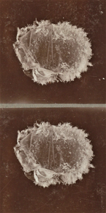 4405 lesmateriaal; microscoop; zwangerschap; eicel; gemelli, circa 1930